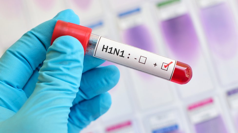 Se da a conocer el primer caso de gripe aviar H5N1 en el Estado de México